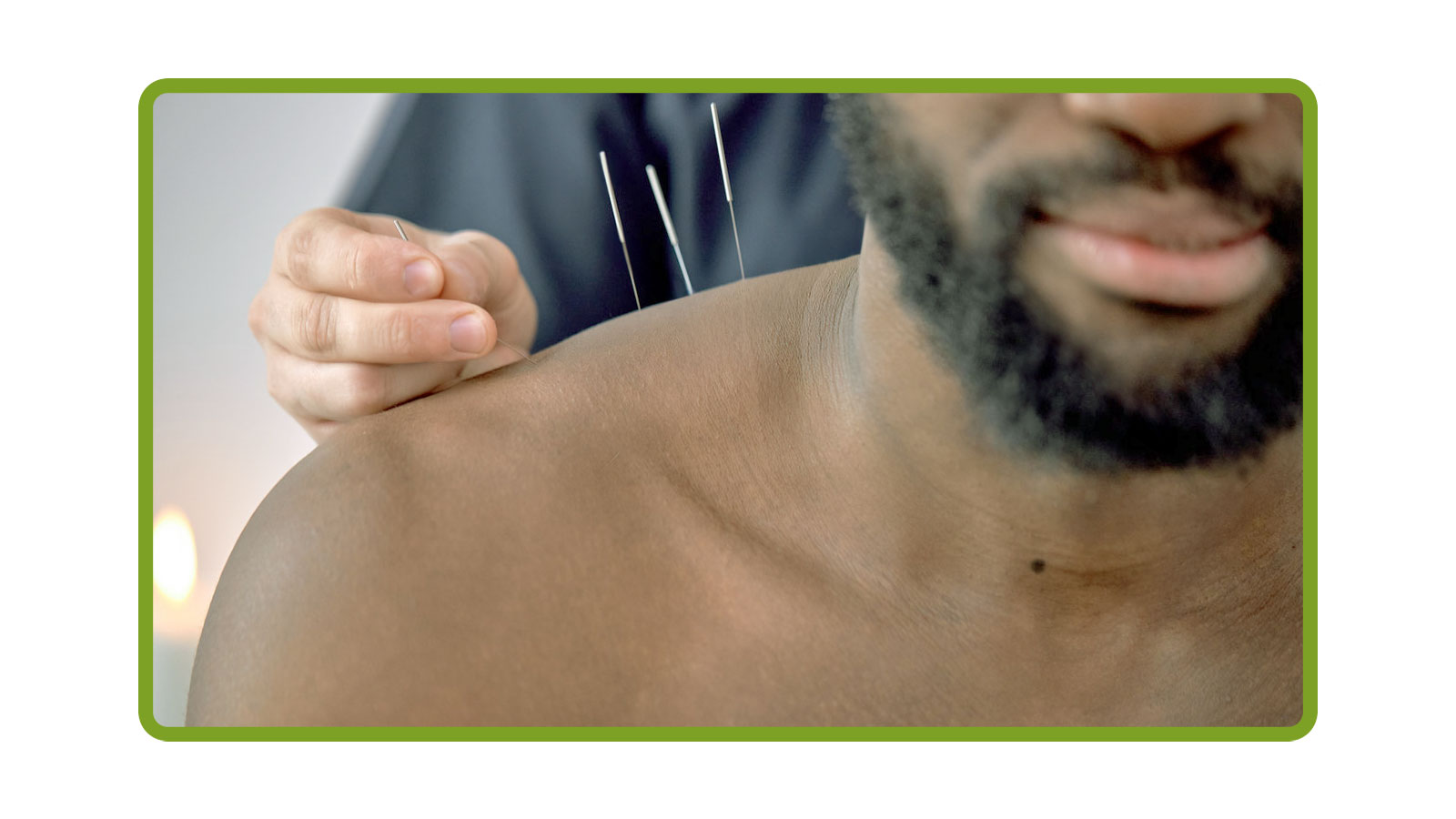 Acupuncture for the Athlete Image