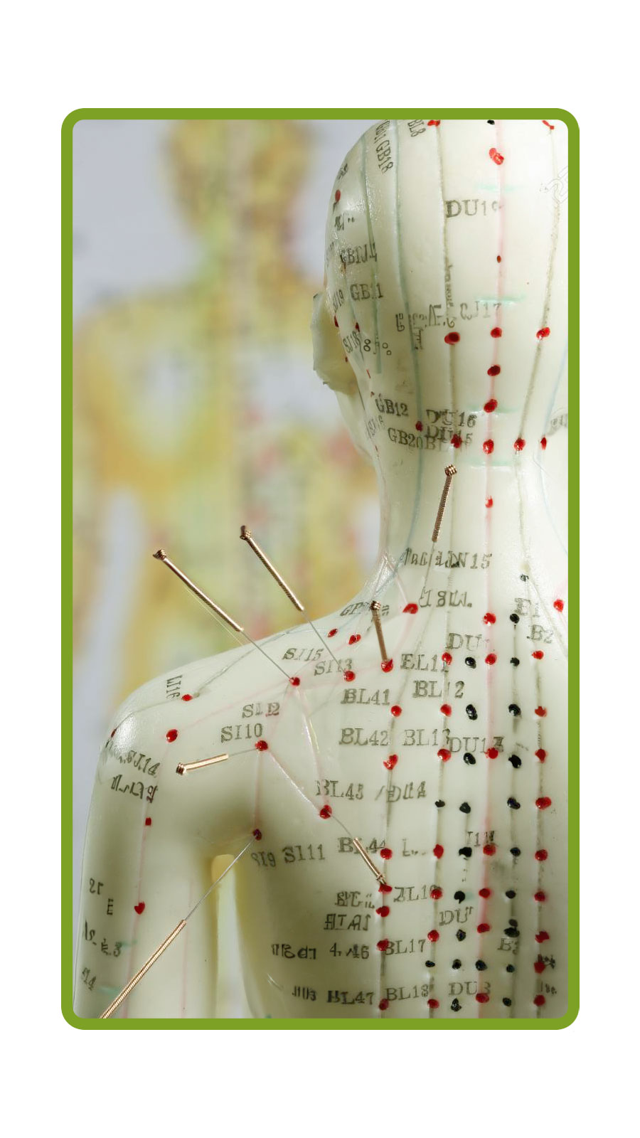 Acupuncture for the Athlete Image